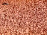 3 - Cellule corticali in visione superficiale